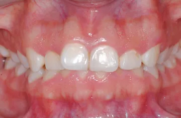 Fotografía clínica