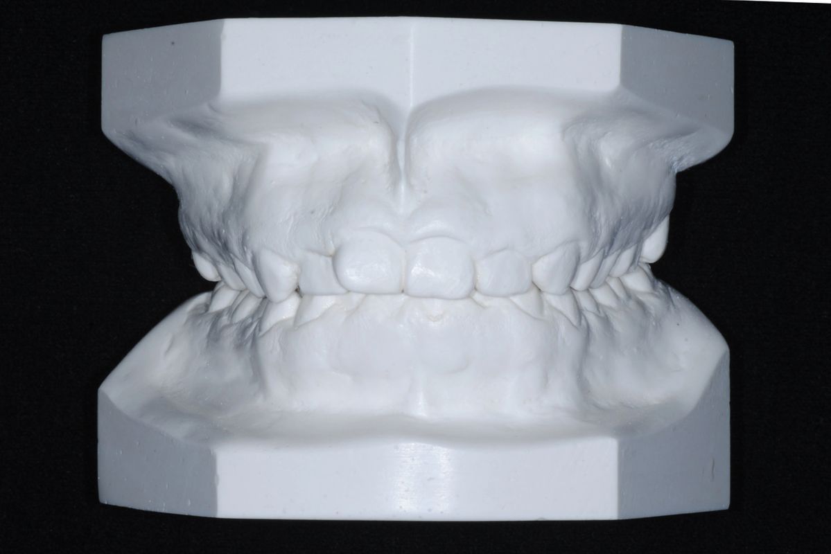 Tomografía CBCT 1