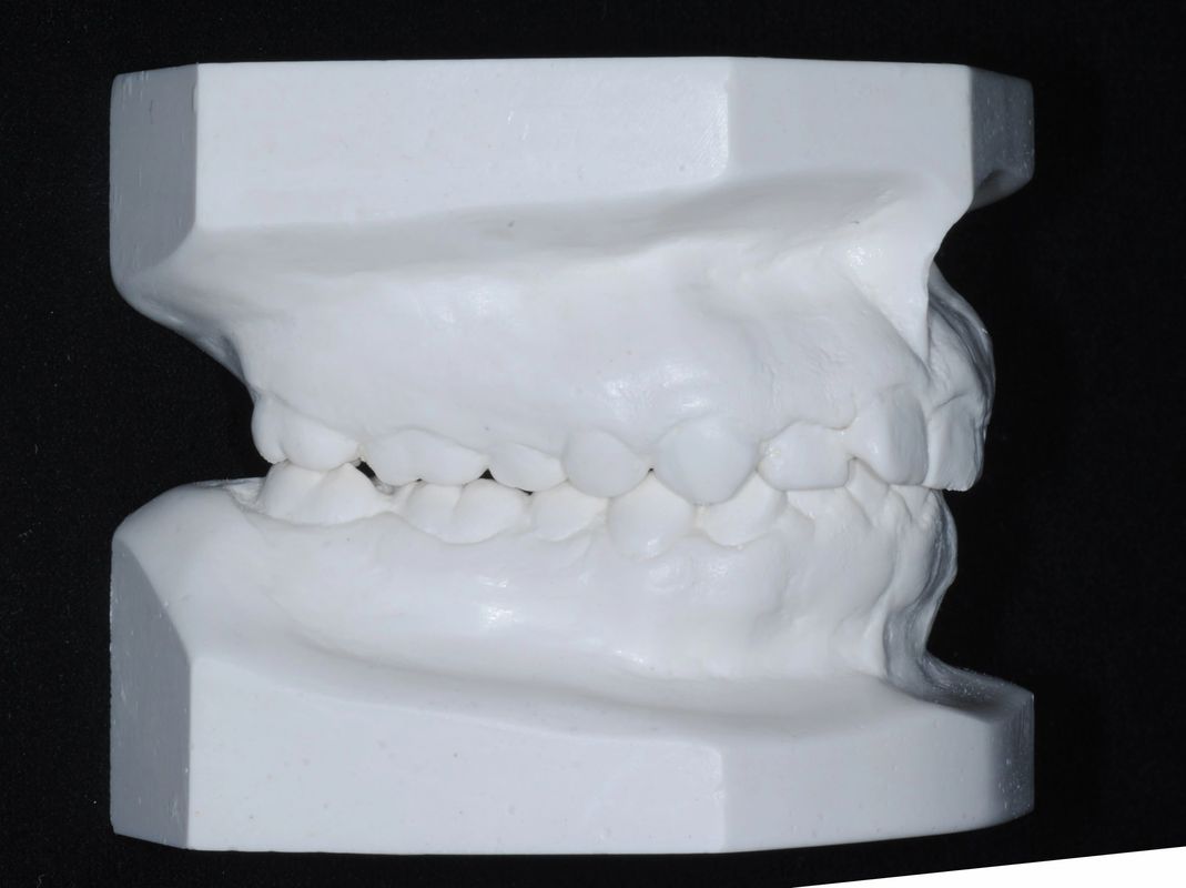 Tomografía CBCT 2