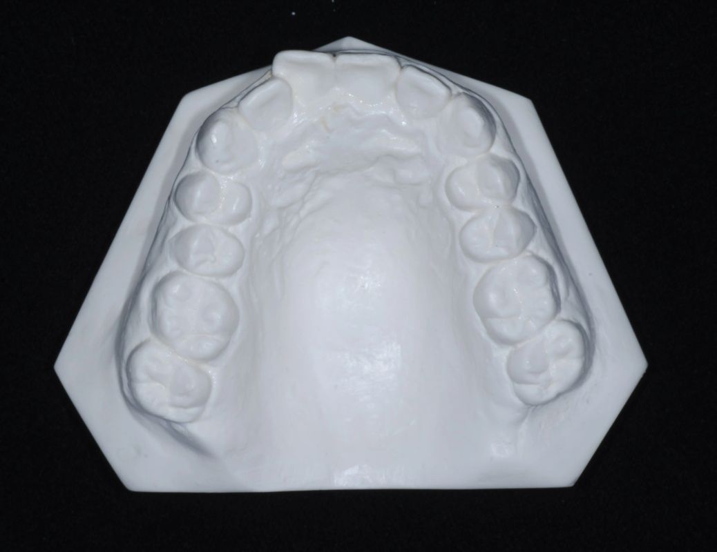 Tomografía CBCT 2