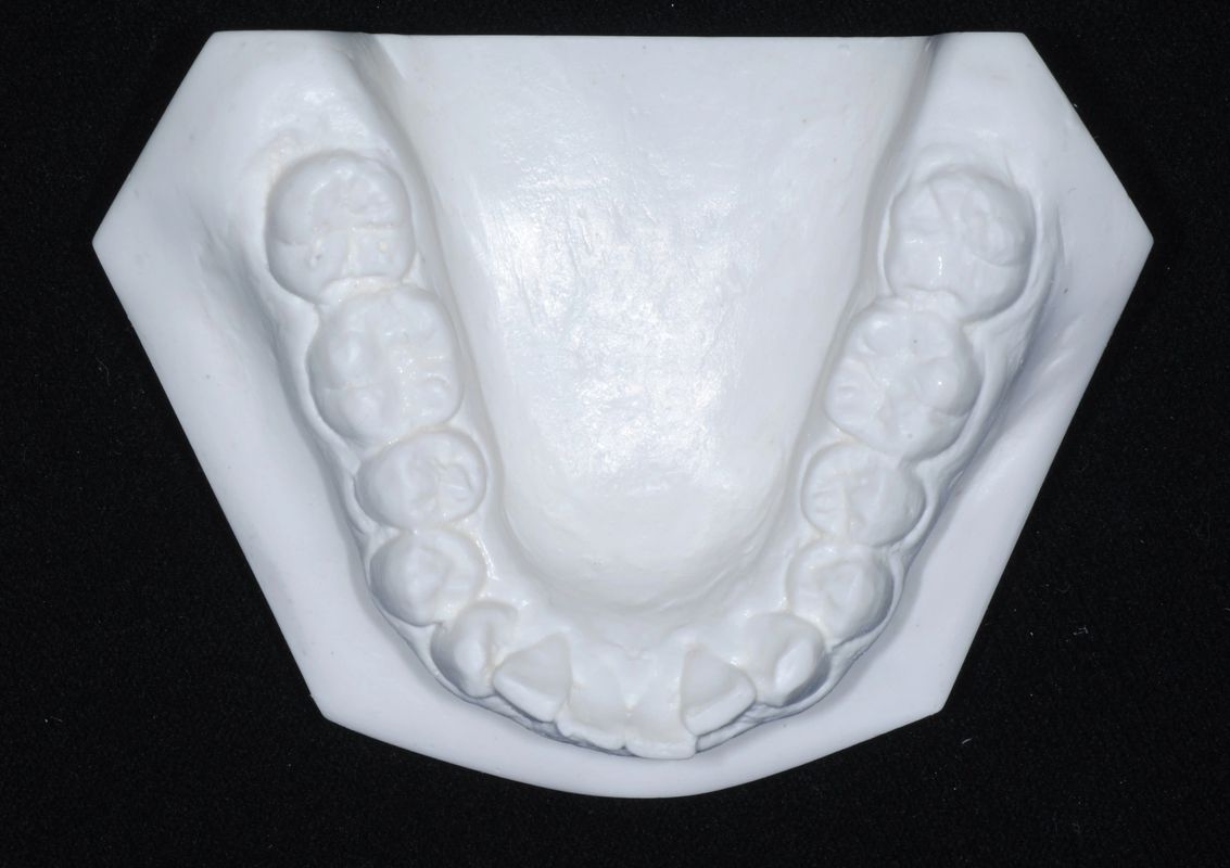 Tomografía CBCT 2