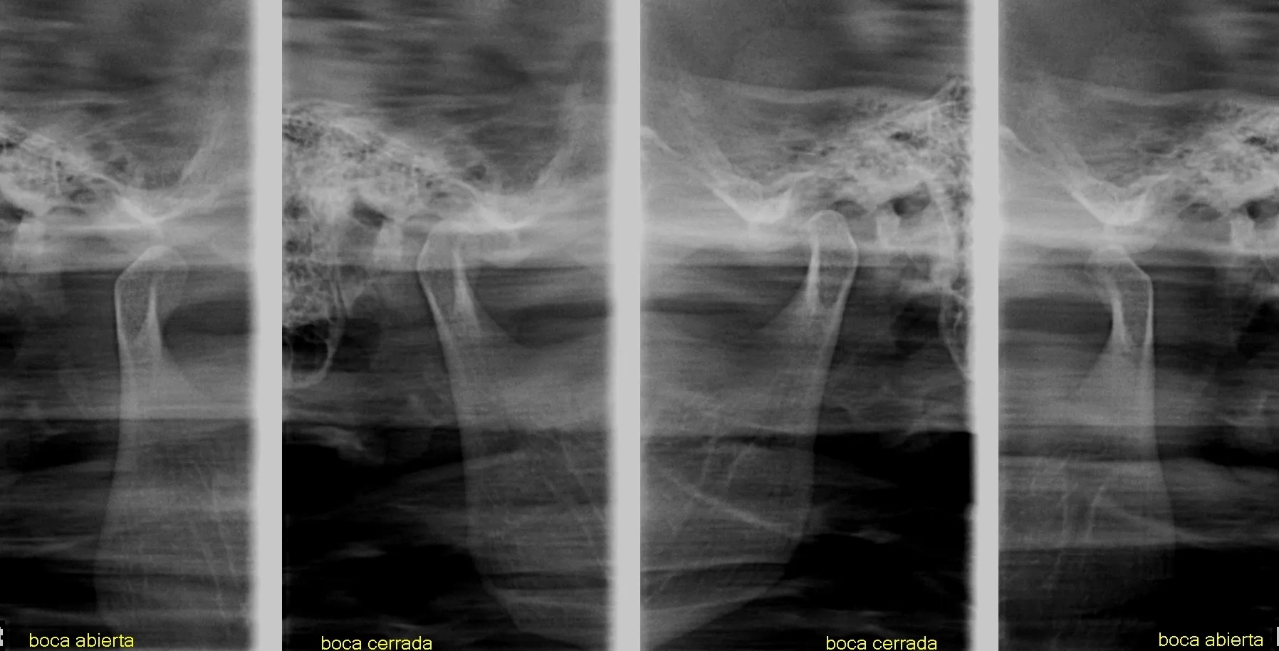 Tomografía CBCT 2