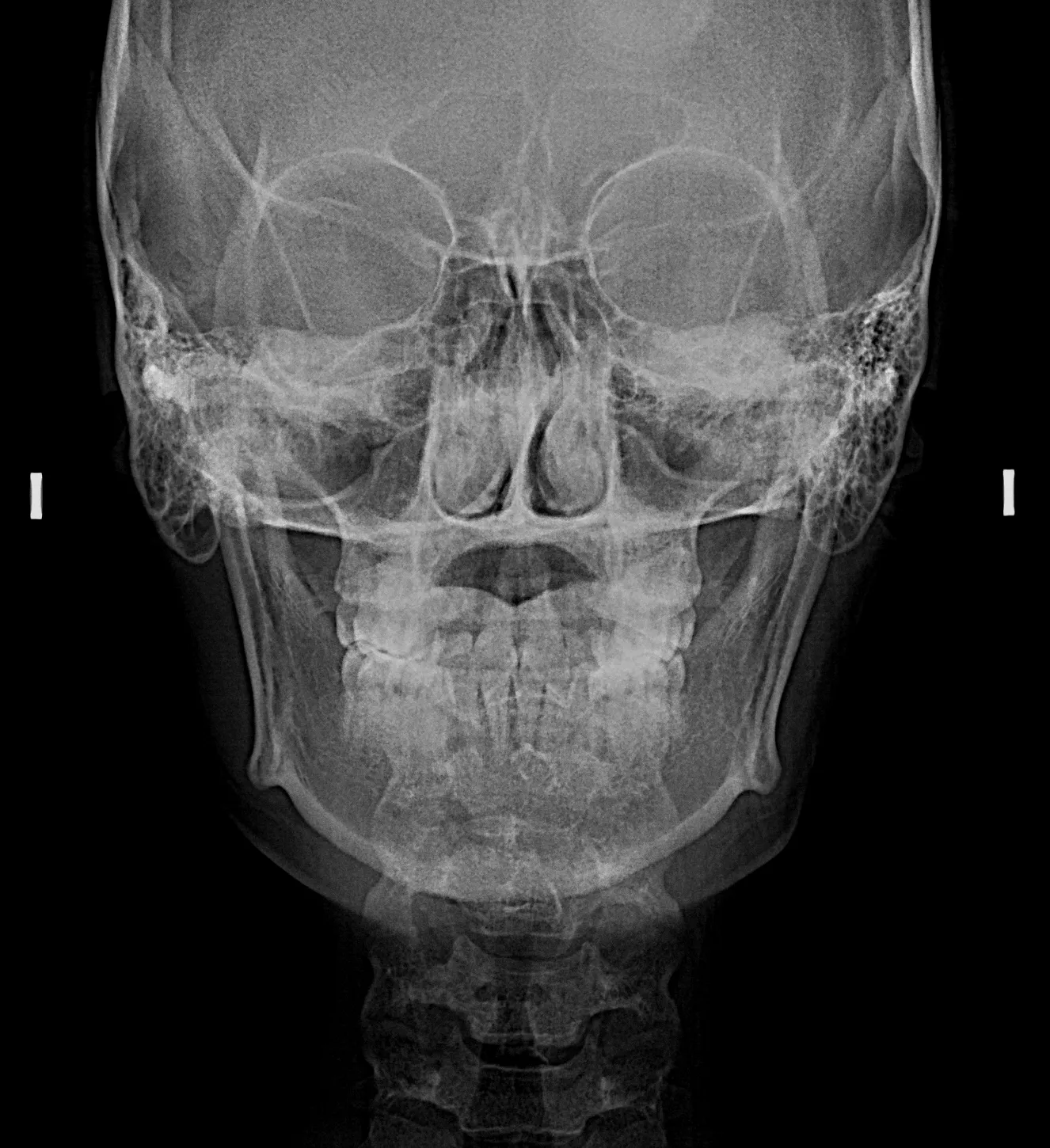 Tomografía CBCT 2