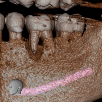 Tomografía CBCT 2